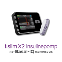 t:slim X2 insulinepomp